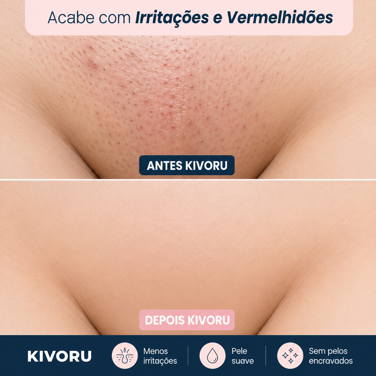 Aparador de Pelos do Biquíni 2 em 1 Sem Dor